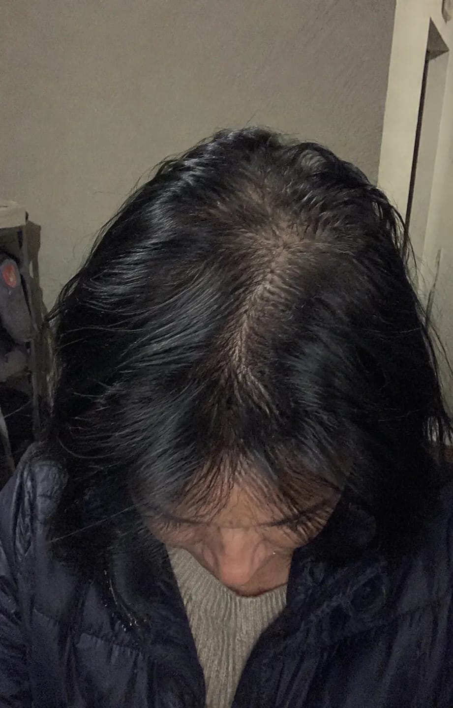 Customer photo review of Barra de Revitalización Capilar Coreana