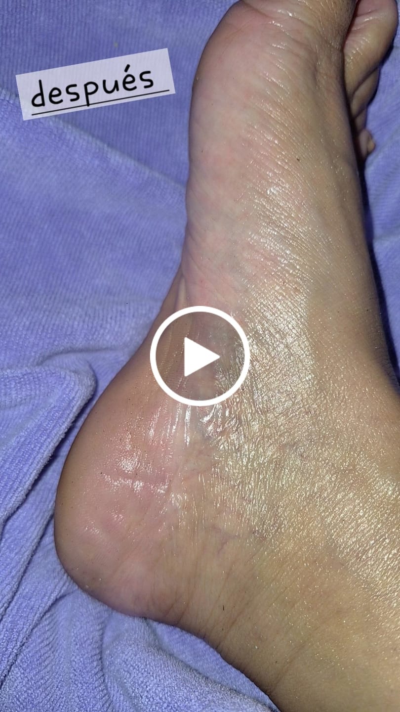 Customer video review of Foot Balm