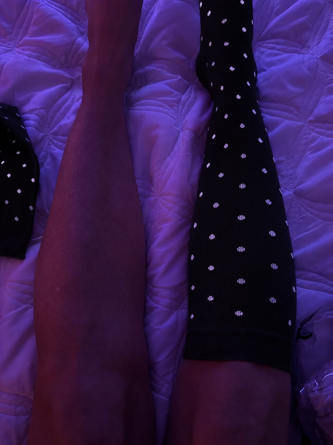 Customer photo review of Bamboo Compression Socks