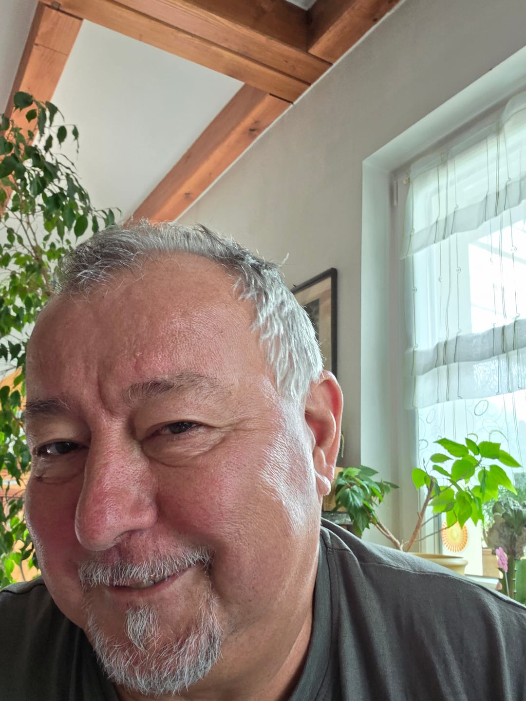 Customer photo review of Alcura™ Ersatzringe für Hautanhängsel