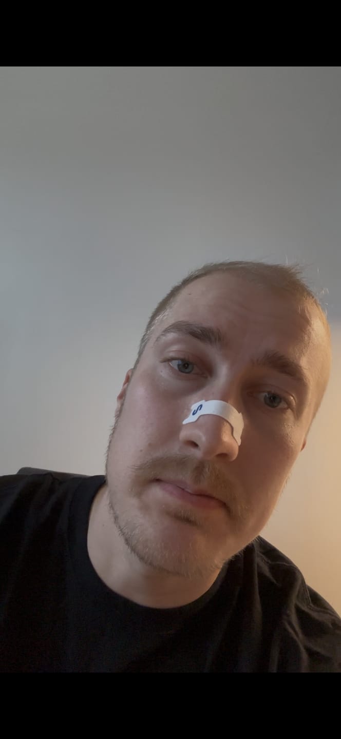 Customer photo review of Nuku Sleep Nasal Strips