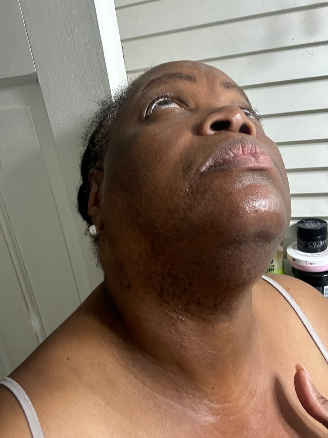 Customer photo review of Hair Reducing Fade Oil - Slows Growth, Thins, and Reduces Hair Naturally