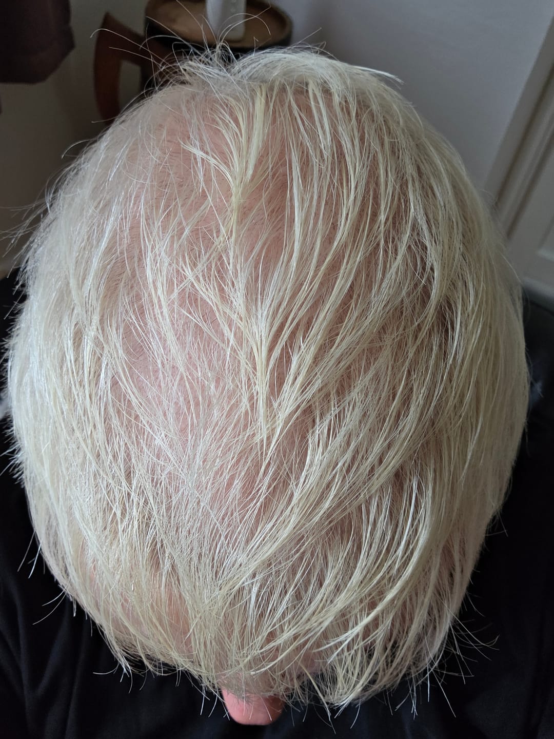 Customer photo review of VITAFOAM ™ Hair Growth Formula