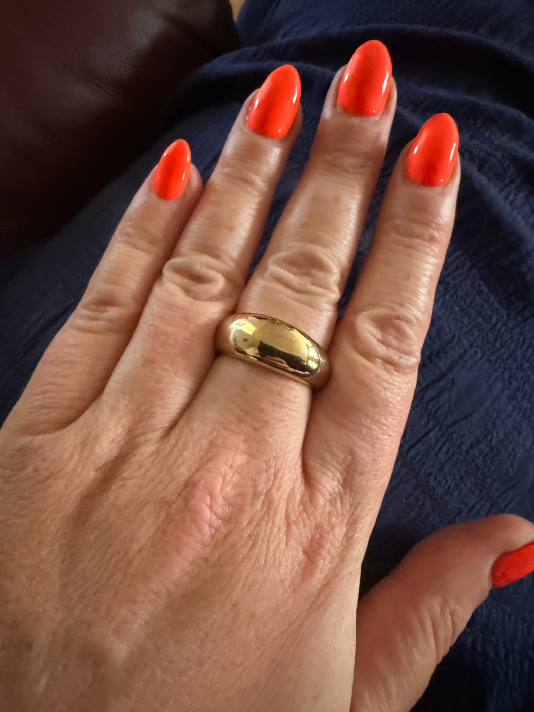 Customer photo review of Chunky Dome Ring