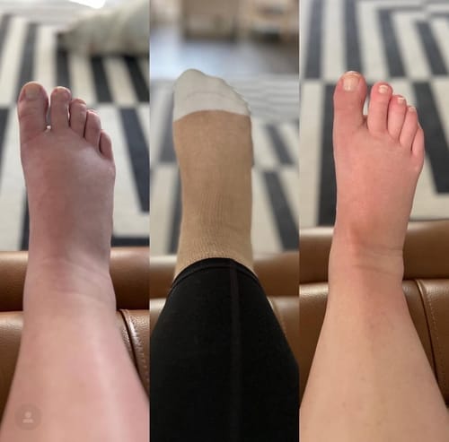 Customer photo review of Bamboo Compression Socks