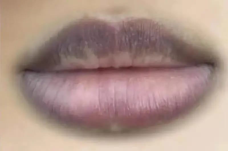 Customer photo review of LEMON LIP BALM | ROZE LIPPEN BINNEN 7 DAGEN