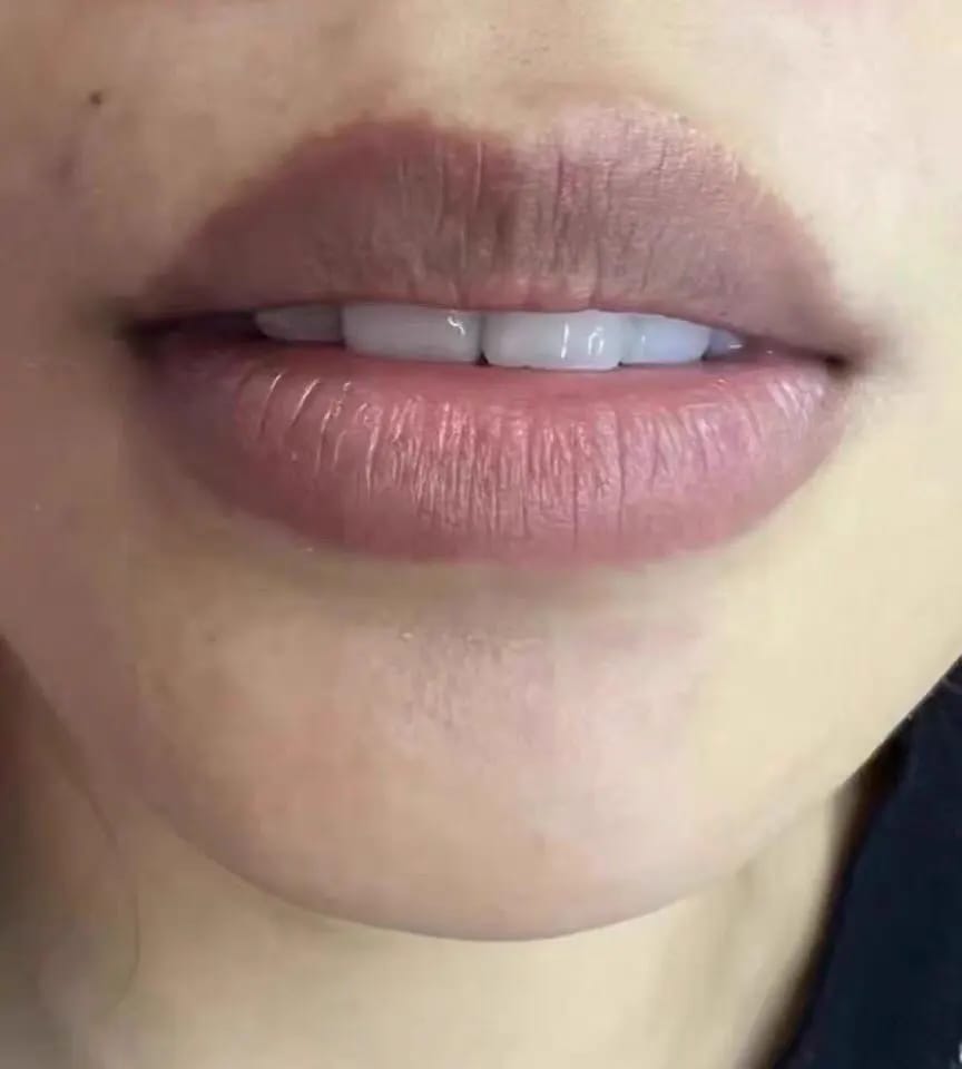 Customer photo review of LEMON LIP BALM | ROZE LIPPEN BINNEN 7 DAGEN