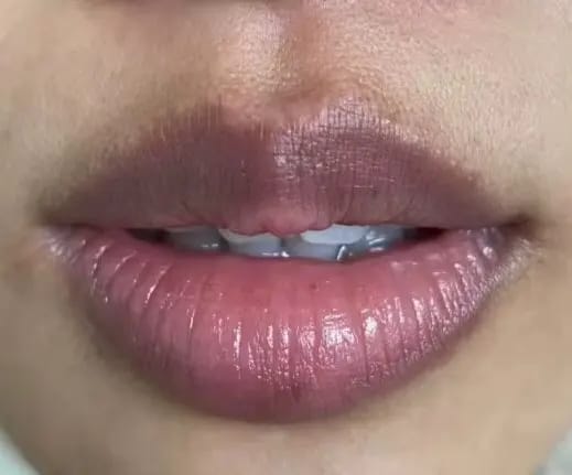 Customer photo review of LEMON LIP BALM | ROZE LIPPEN BINNEN 7 DAGEN