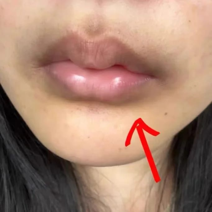 Customer photo review of LEMON LIP BALM | ROZE LIPPEN BINNEN 7 DAGEN