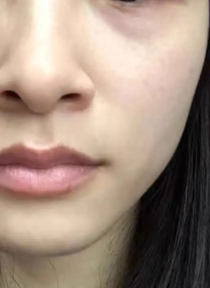 Customer photo review of LEMON LIP BALM | ROZE LIPPEN BINNEN 7 DAGEN