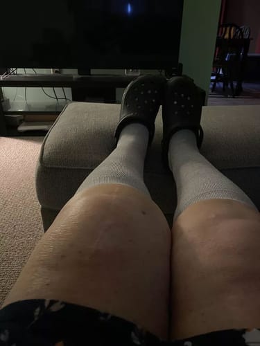Customer photo review of Bamboo Compression Socks