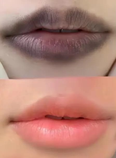 Customer photo review of LEMON LIP BALM | ROZE LIPPEN BINNEN 7 DAGEN