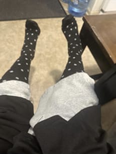 Customer photo review of Bamboo Compression Socks
