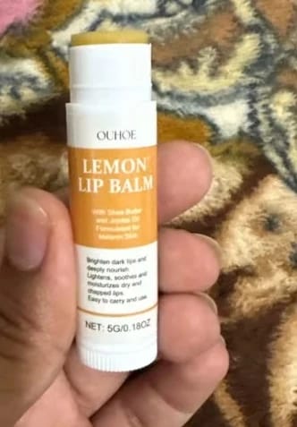 Customer photo review of LEMON LIP BALM | ROZE LIPPEN BINNEN 7 DAGEN