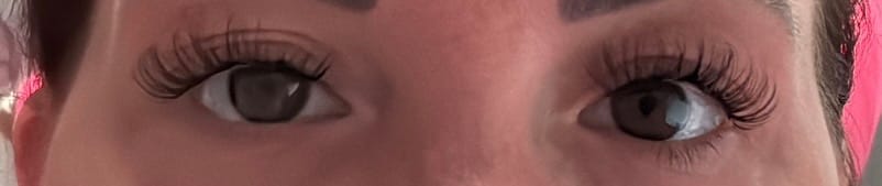 Customer photo review of THE CANCER (Krebs 5-11 mm)