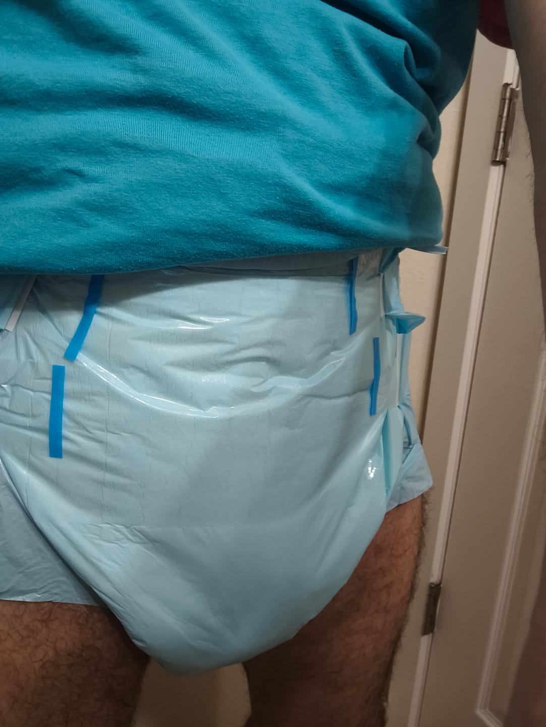 Customer photo review of SUNKISS Masterpiece Adult Diapers With Tabs