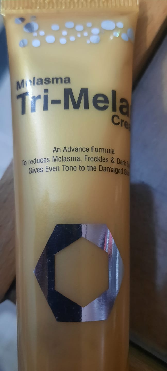 Customer photo review of Tri Melas Cream - Best Melasma Cream