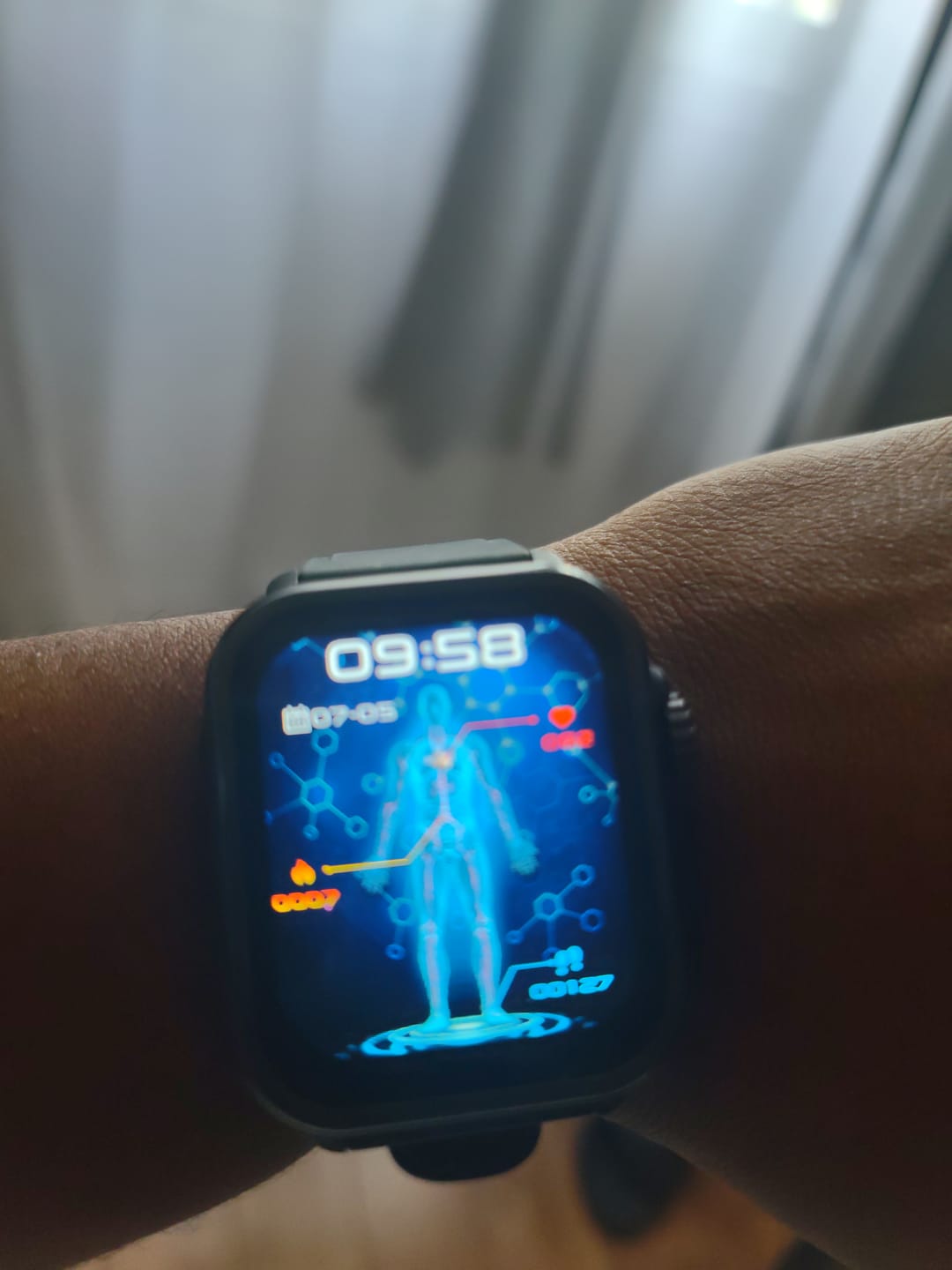 Customer photo review of Fitaos VEE ECG/EKG Blood Glucose Blood Oxygen Heart Rate Monitoring Sport SmartWatch