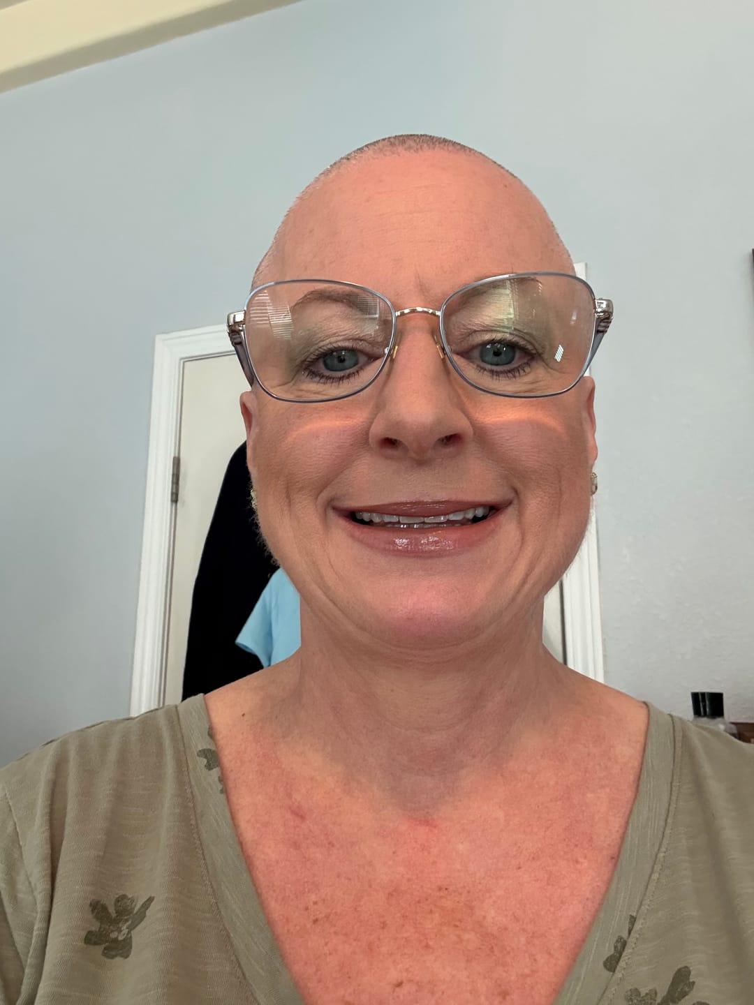 Customer photo review of Best Moisturizer for Chemo Scalp