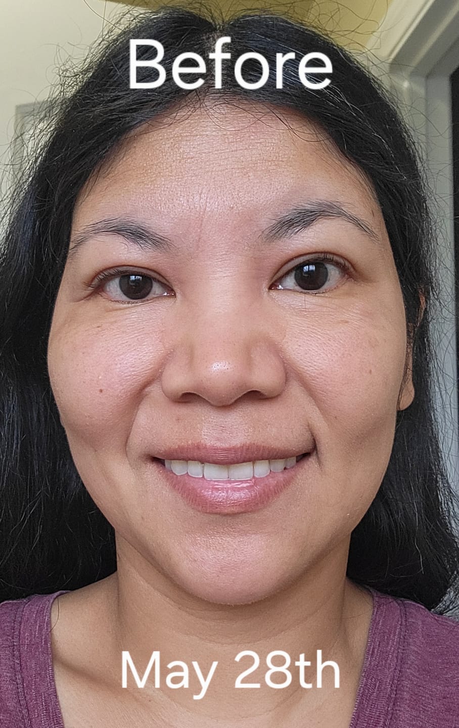 Customer photo review of Anti-Age & Insane Glow Day Balm