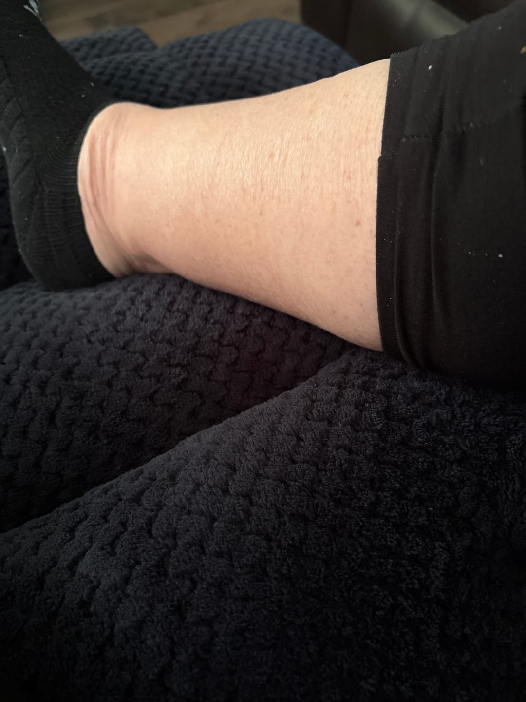 Customer photo review of Baby Body Balm