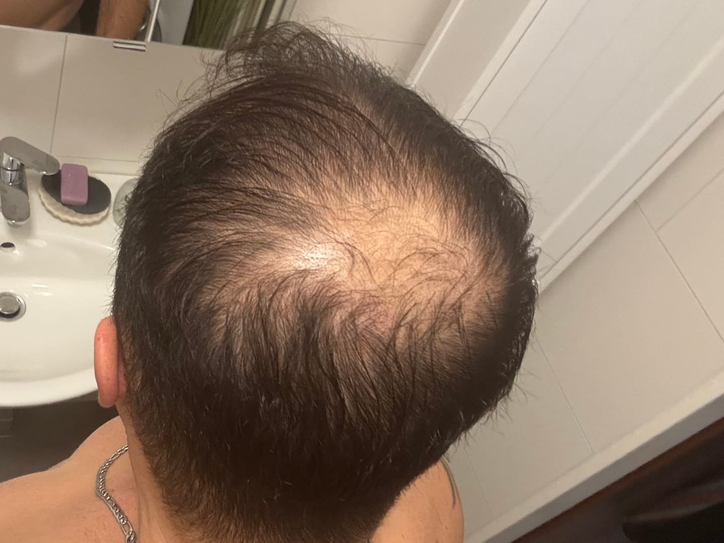 Customer photo review of Arganöl+ von IMPERIO®