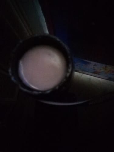 Customer photo review of Max Strength Moisturizing Razor Bump Relief Cream (.5oz)