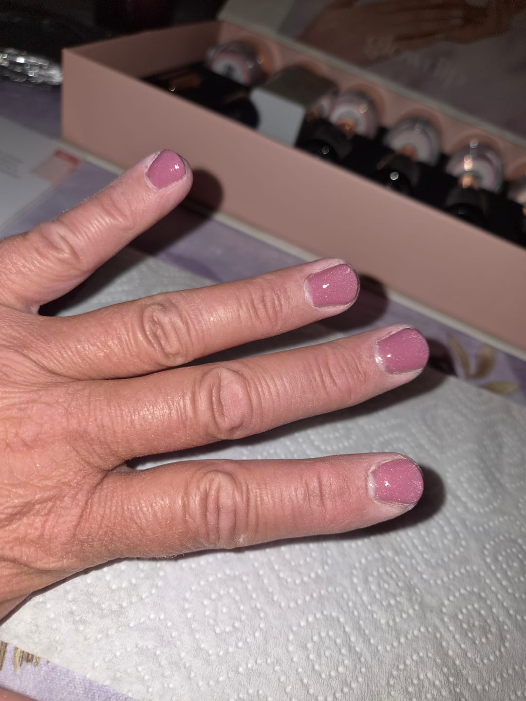 Customer photo review of Verzending Verzekering