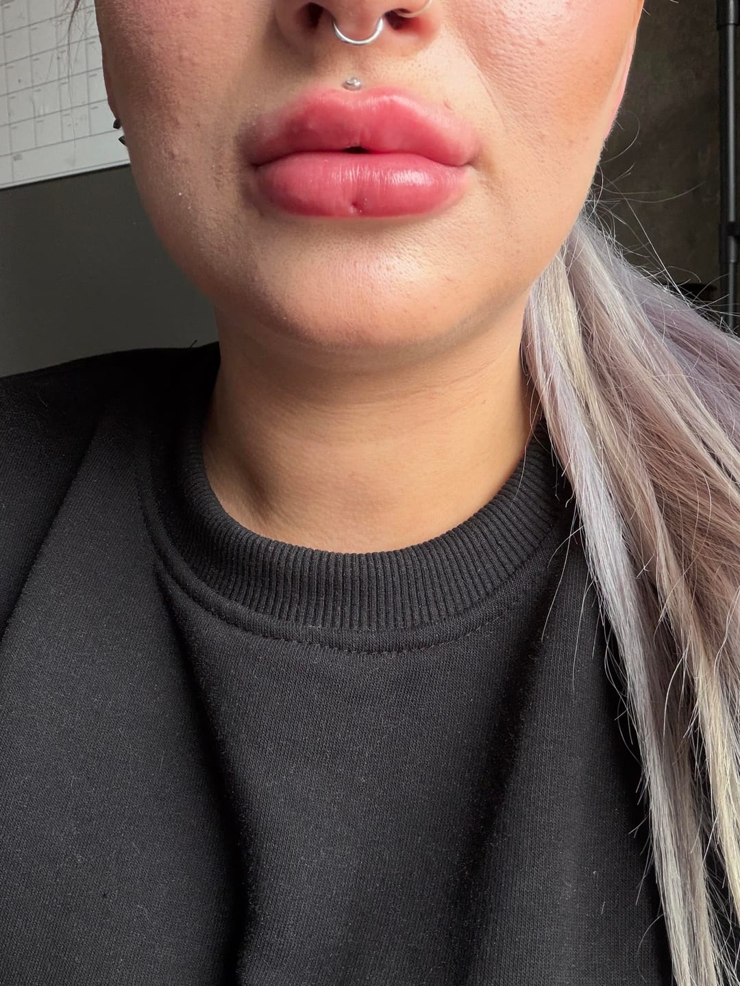 Customer photo review of Bellaré Lip Plumper