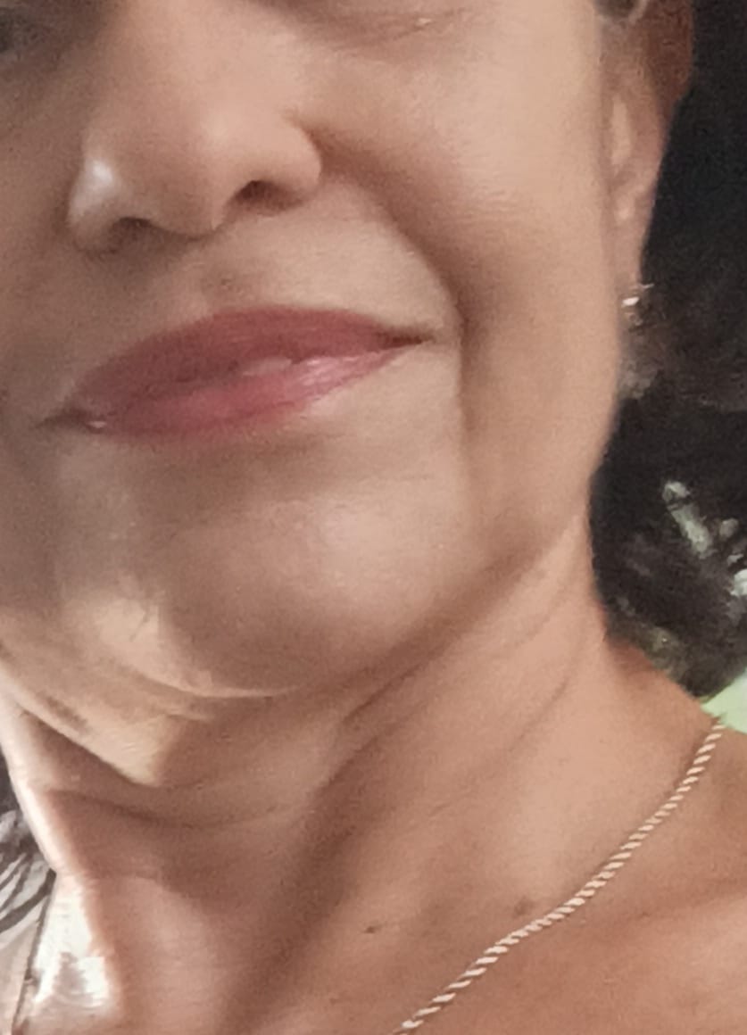 Customer photo review of Solução Exossomos + PDRN + Peptídeos