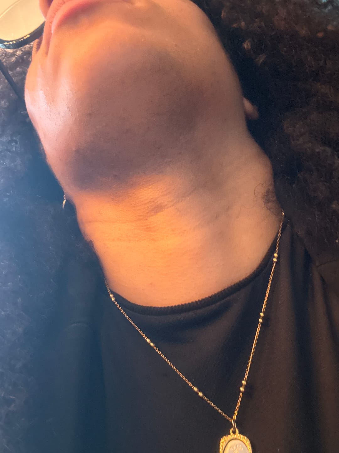 Customer photo review of Hair Reducing Fade Oil - Slows Growth, Thins, and Reduces Hair Naturally