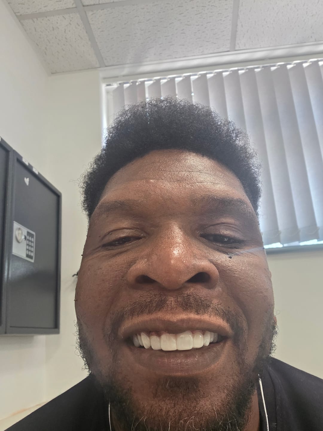 Customer photo review of Click-in Veneers 4.0