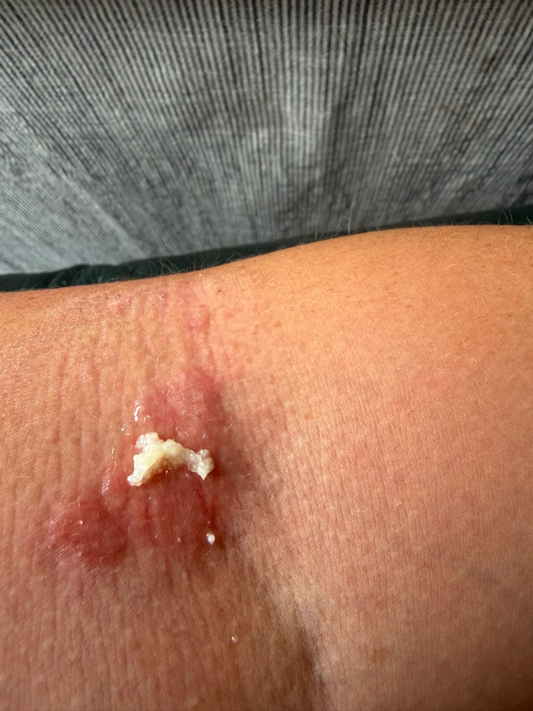 Customer photo review of Grass-Fed Tallow Body Balm | Cold Weather Protection