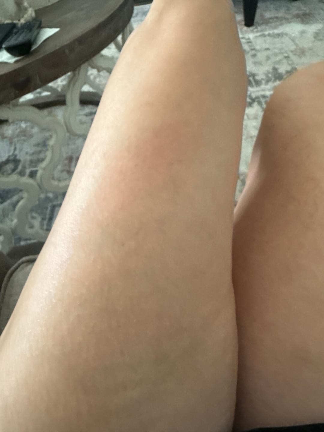 Customer photo review of Besque® Magic Body Oil XL - 200ml