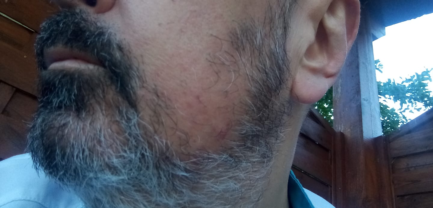 Customer photo review of Sérum Thorin | Huile de croissance de Barbe