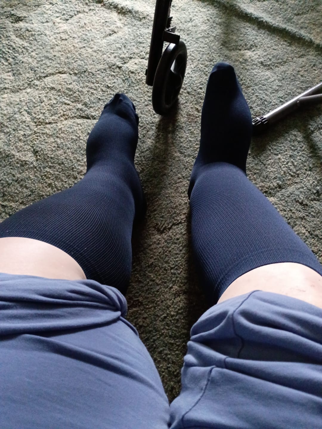 Customer photo review of EverSock™ Wide Compression Socks For Pain Relief