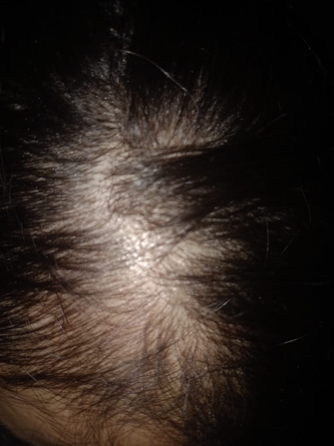 Customer photo review of Anagrow Shampoo