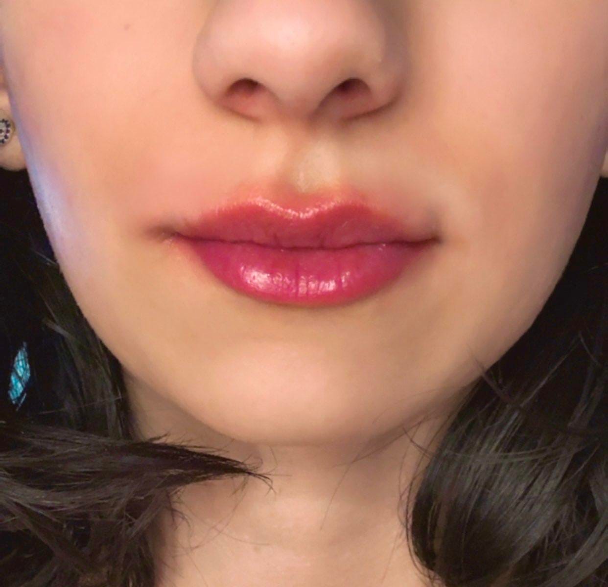 Customer photo review of Bellaré Lip Plumper