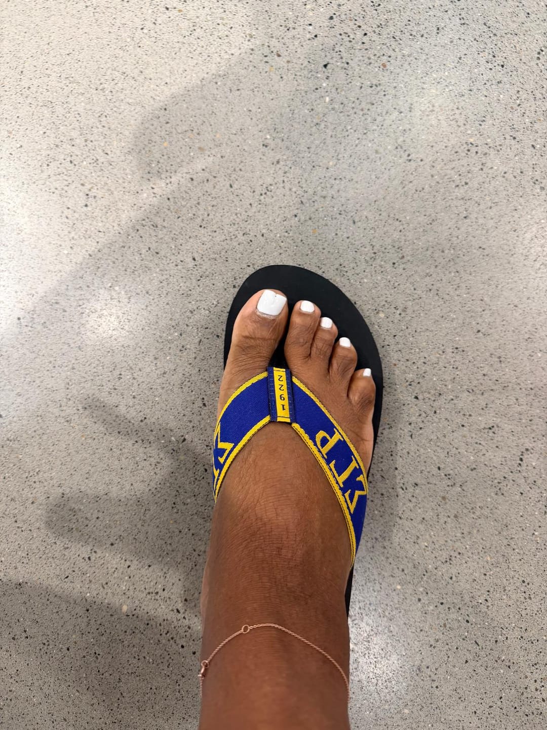 Customer photo review of SGRHO Flip flops
