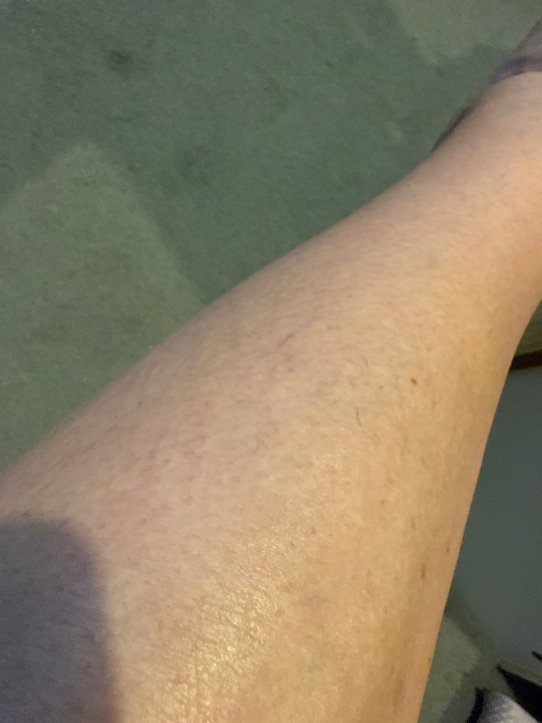 Customer photo review of Whipped Grass-Fed Tallow Body Cream | With Jojoba Oil