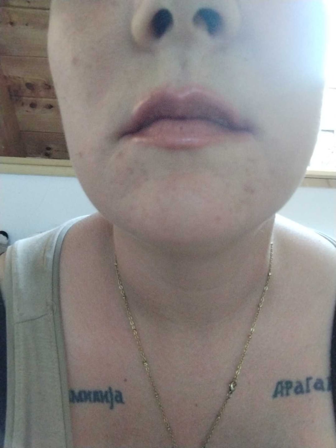 Customer photo review of Bellaré Lip Plumper
