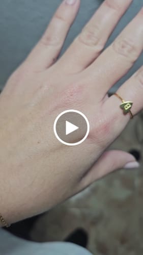 Customer photo review of Anillo Inicial