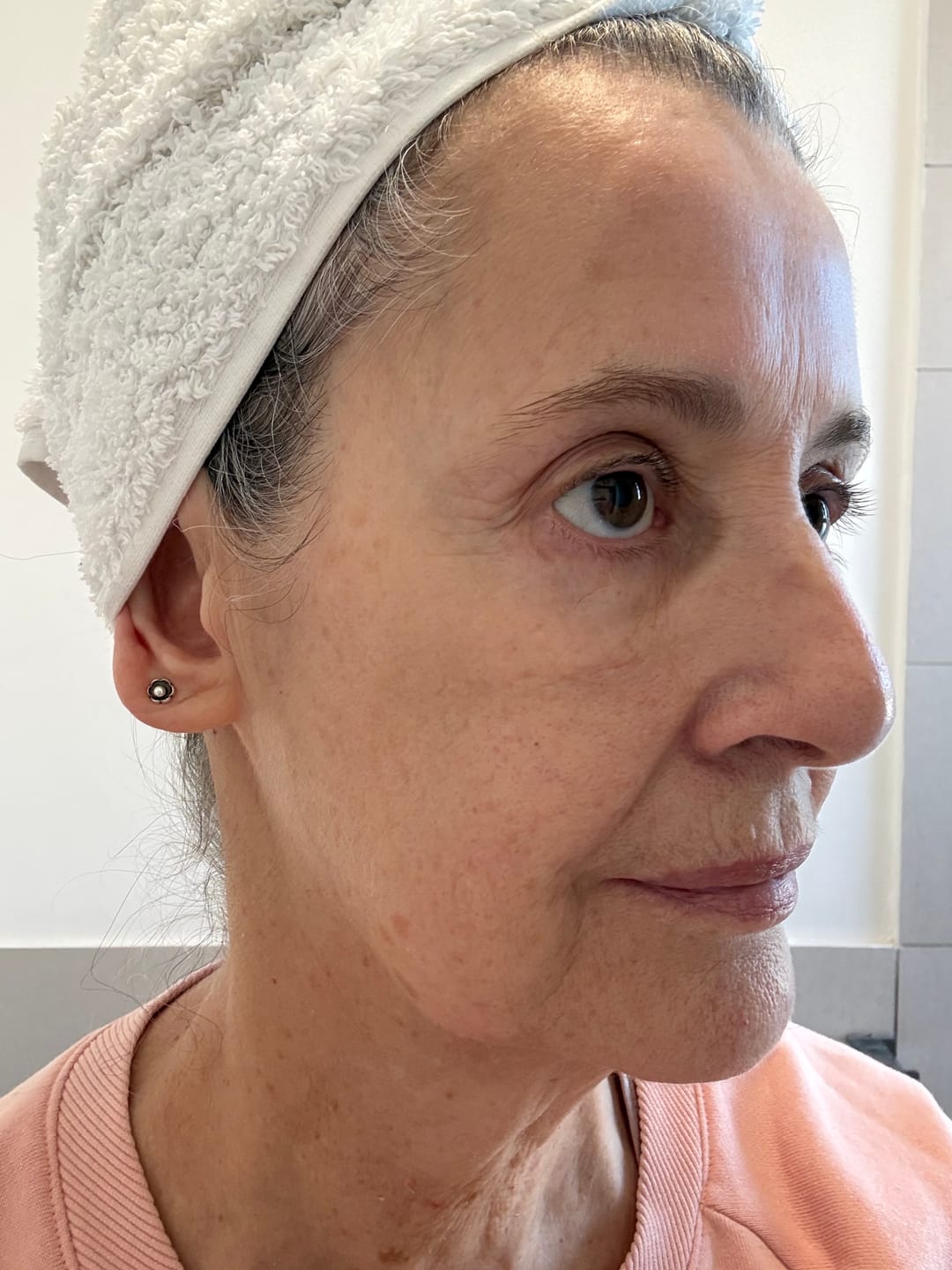 Customer photo review of The Super Glo Hydro Boost Jelly Moisturiser