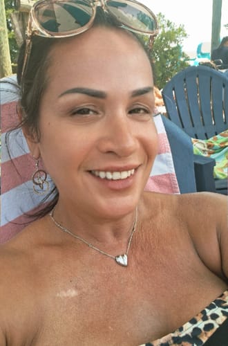 Reviewer smiling, showing the results on their face and chest after using the Seranova Micro Infusion System.