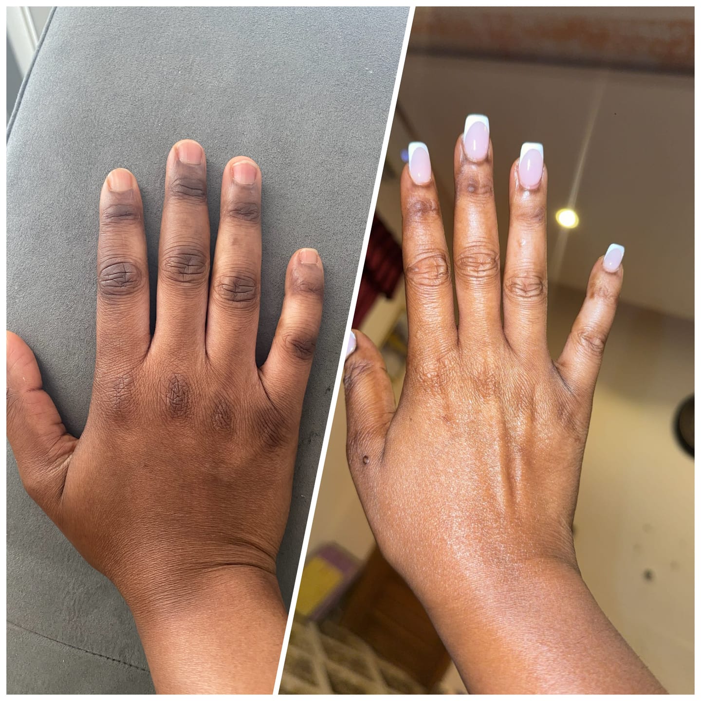 Customer photo review of Rapid Fading Dark Knuckle Treatment (Results Driven )