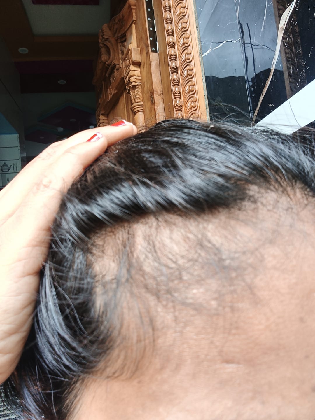 Customer photo review of Advance Hair Growth Serum 2.0 (30ml)