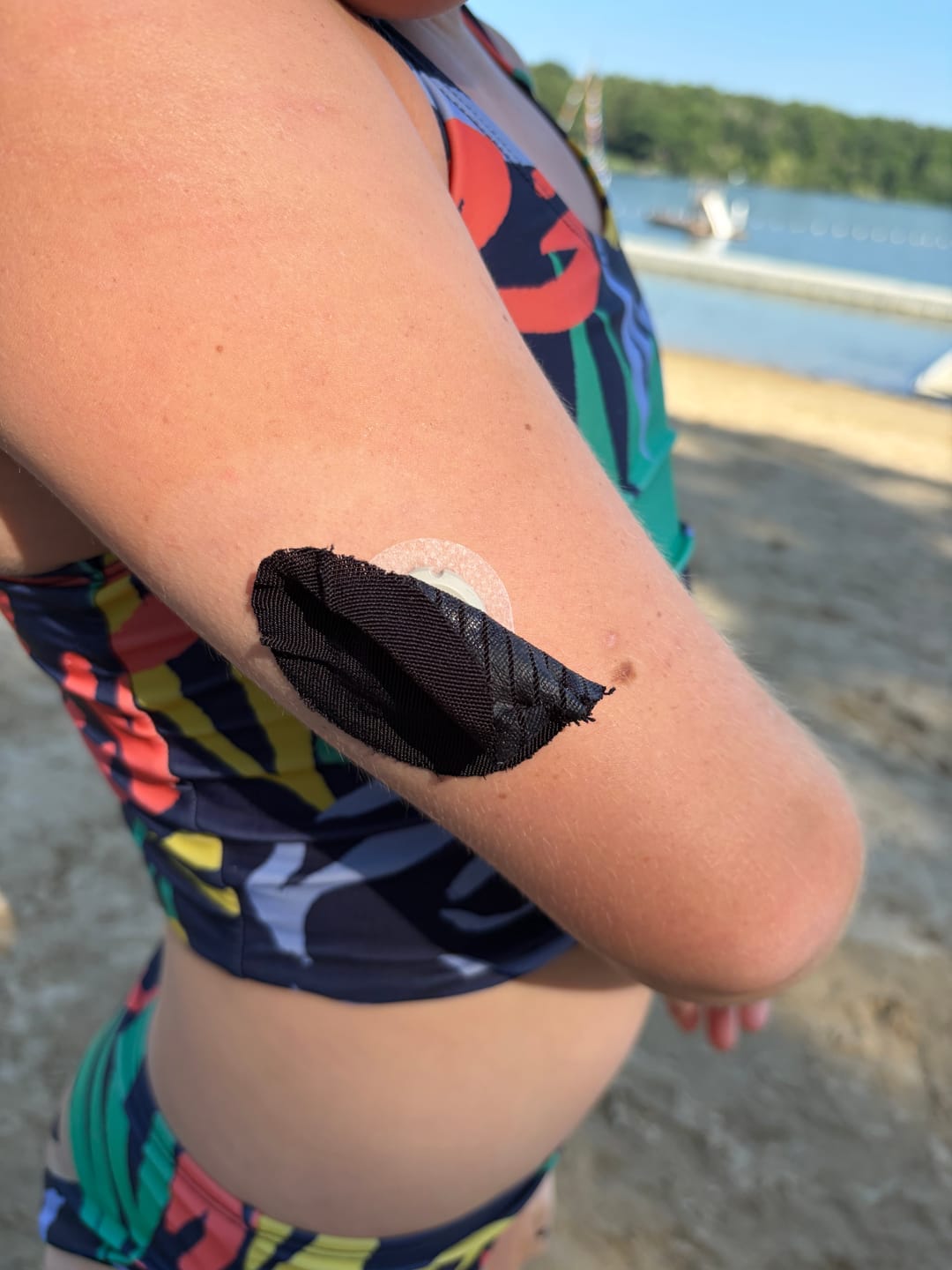 Customer photo review of Skin Grip Original - Dexcom G7 & Stelo Adhesive Patches