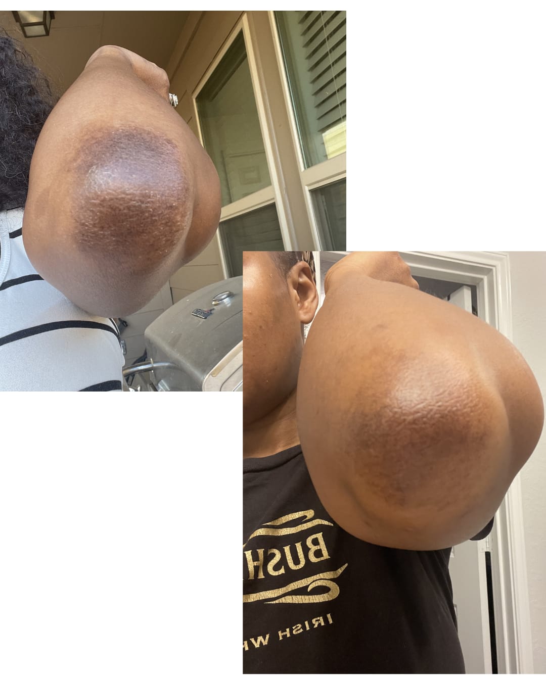 Customer photo review of Rapid Fading Dark Knuckle Treatment (Results Driven )