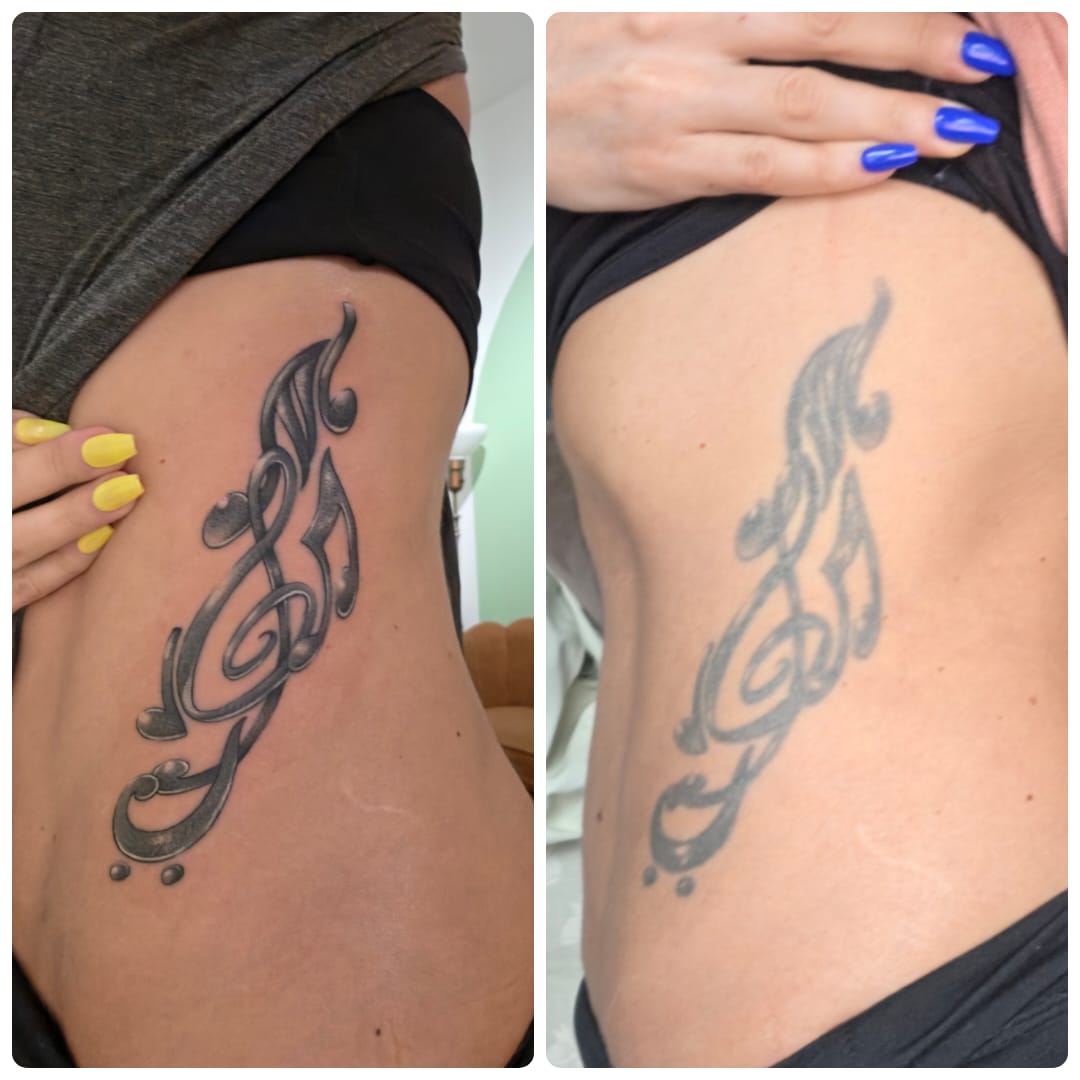Customer photo review of Signature Tattoo Numbing Cream