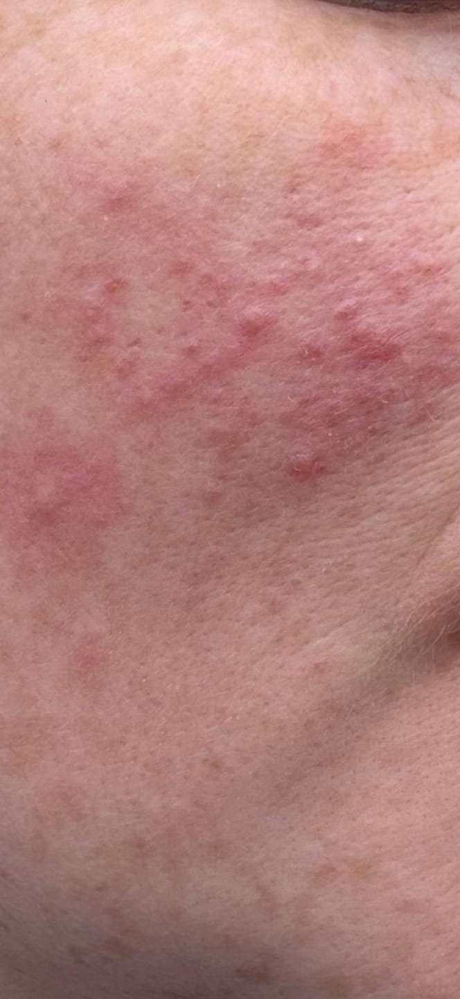 Customer photo review of Rosalique Soothing Night Cream
